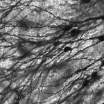 Окрашенные по методу Гольджи человеческие нейроны в гиппокампальной ткани 